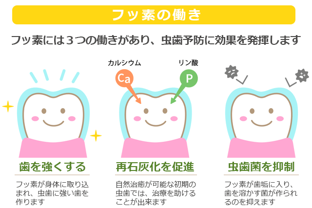 子供を虫歯にさせないためには 札幌歯科 札幌の世界標準のインプラント歯医者